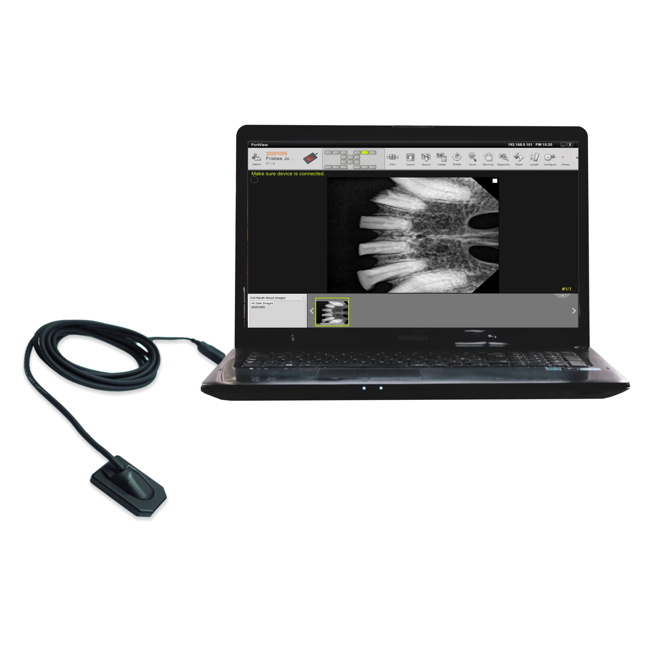 PortView - Digital Dental Intra-Oral Sensor For Zen-PX4 3 PortView - Digital Dental Intra-Oral Sensor For Zen-PX4 - Image 3